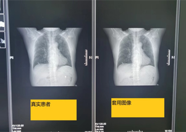 团伙式作案、全链条造假、恶意对抗调查 国家医保局通报无锡虹桥医院调查情况